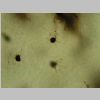 Oligodendroglia Golgil 08.jpg